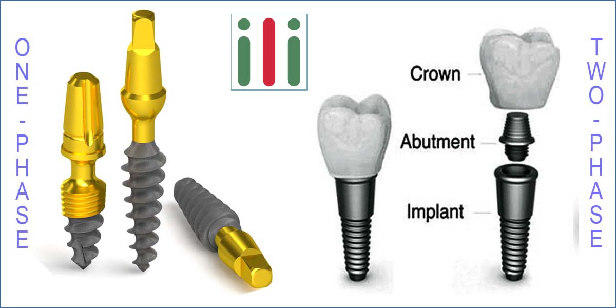 Comparison of One-phase Implants to Two-phase Conventional Implants