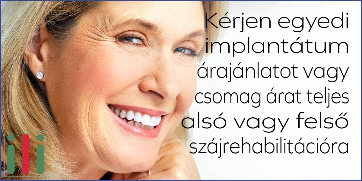 Implantátum beültetés csomagár - Mennyibe Kerül Egy Komplett Száj Rehabilitáció?