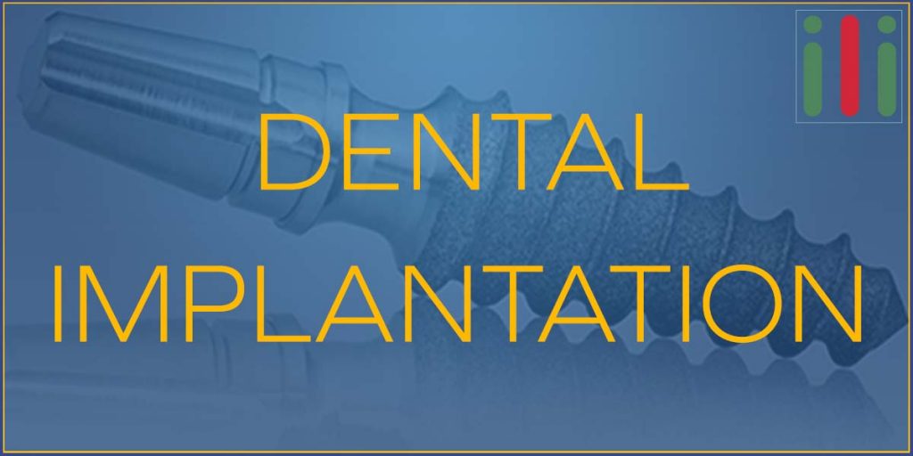Dental Implantation - What You Need to Know About Implantation Process
