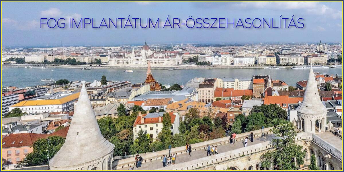 Fog implantátum ár-összehasonlítás - Miért érdemes bennünket választani
