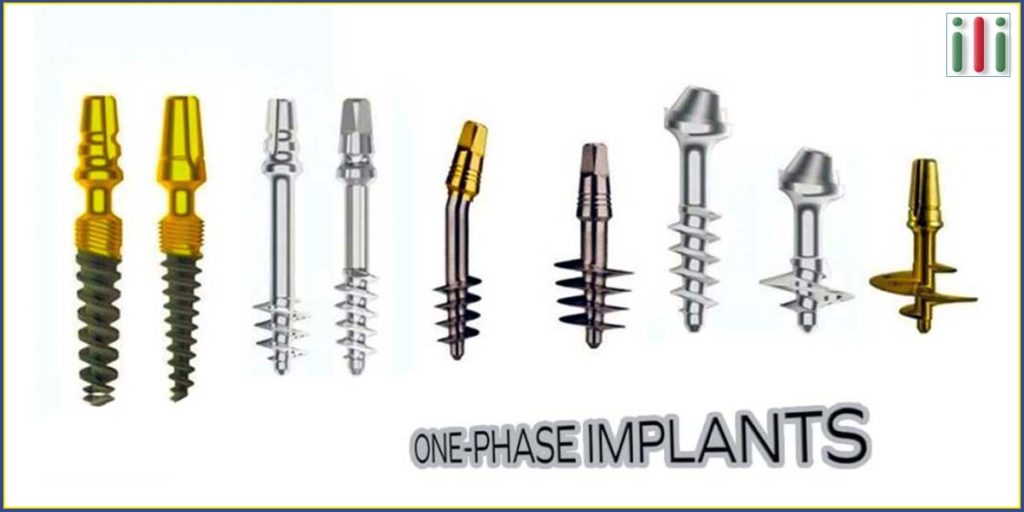 Dental implants - frequently asked questions and answers