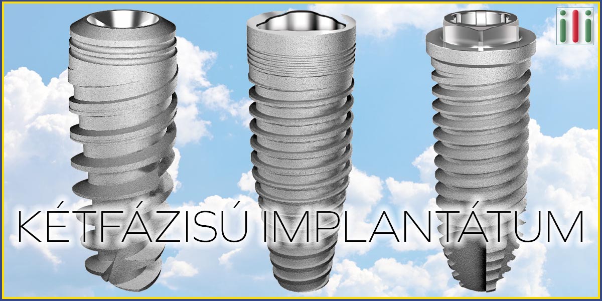 A kétfázisú implantátum negatív jellemzői - Melyek azok?