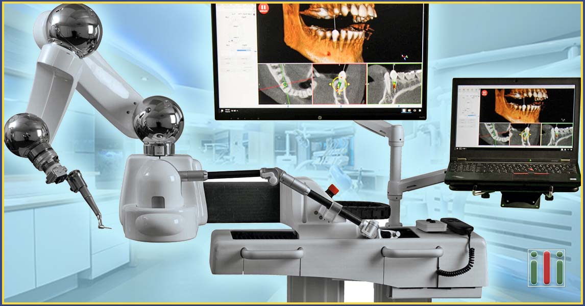 Robot-assisted dental implantation - Welcome to the 21st century