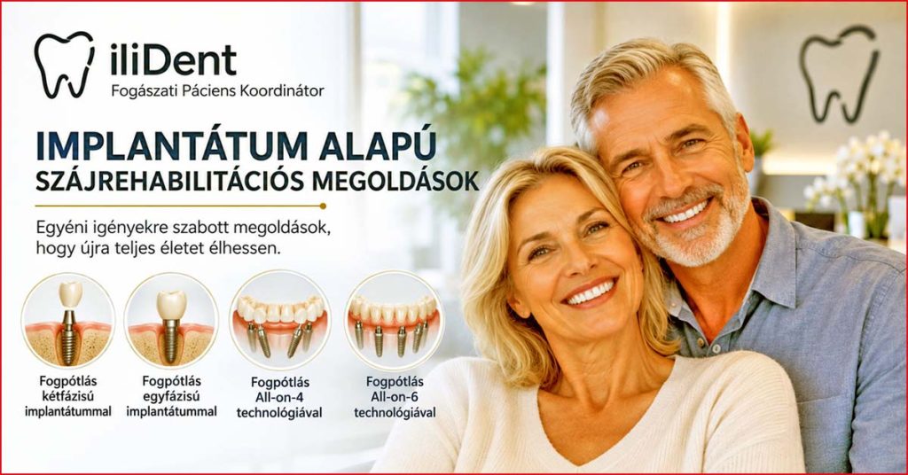Implantátum alapú szájrehabilitáció egyfázisú, kétfázisú, All-on-4 és All-on-6 megoldásokkal