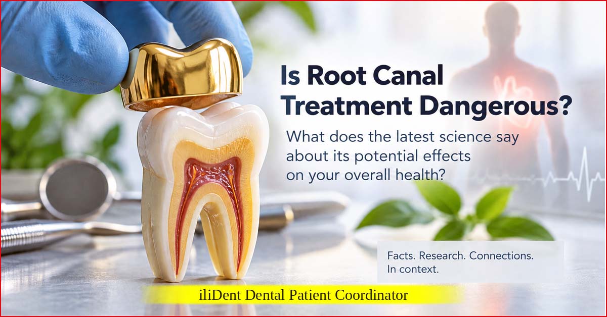 Is root canal treatment dangerous? Weston A. Price’s theory and the current scientific perspective