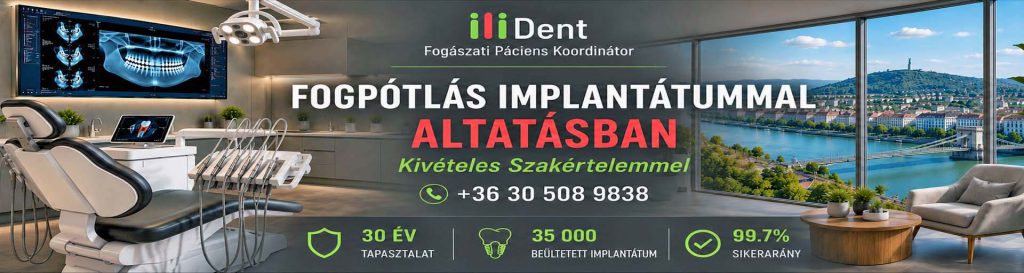 iliDent Fogászati Páciens Koordinátor - Fogpótlás implantátummal.