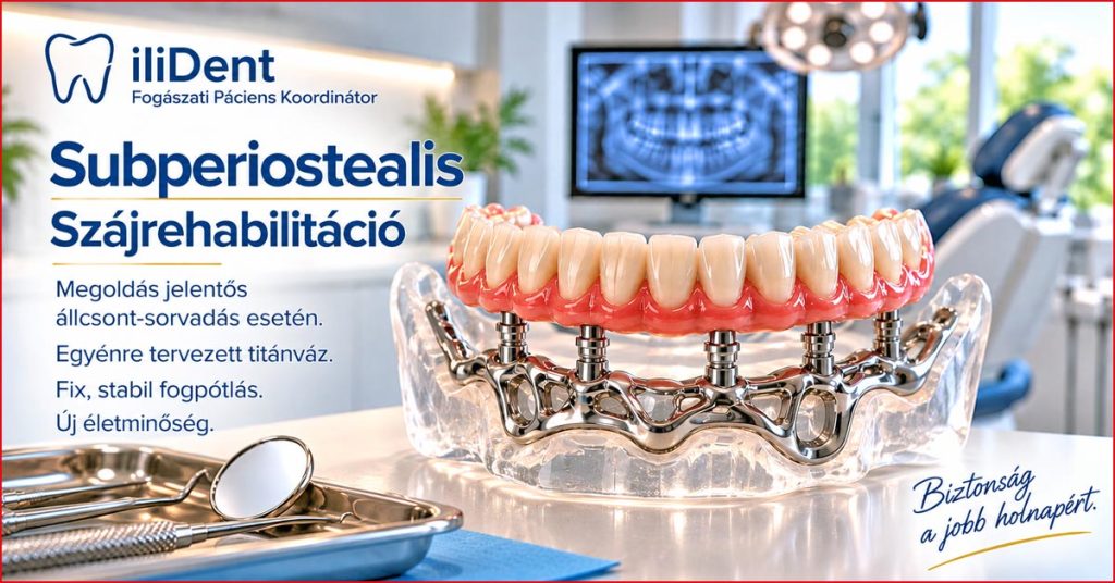Egyénre tervezett subperiostealis titánvázra rögzített fogpótlás jelentős állcsonti csontveszteség esetén.